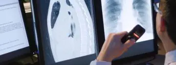 Nuance Radiology Conversational AI workflow