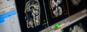 healthcare scan