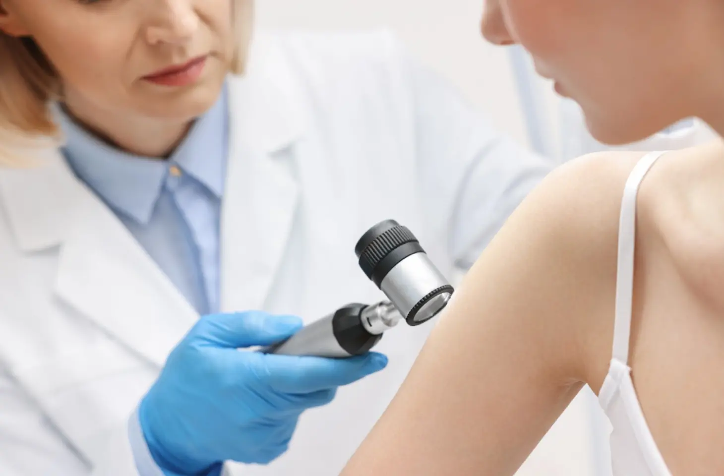 AI spoort huidkanker op: is het een kwaadaardig vlekje of niet?