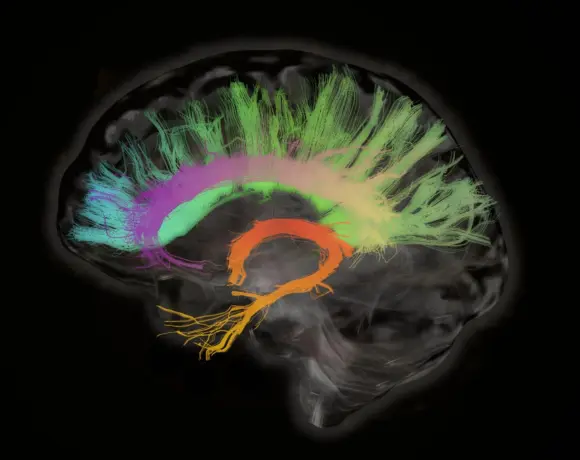 Cranium baart Cingulum: verbinden en beschermen met extra aandacht voor regelgeving