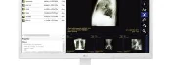 De thin clients als oplossing voor strikte medische regelgeving