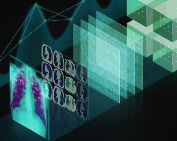 Microsoft Azure ondersteunt voortaan Nvidia GPU Cloud voor deep learning