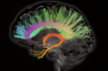 Cranium baart Cingulum: verbinden en beschermen met extra aandacht voor regelgeving